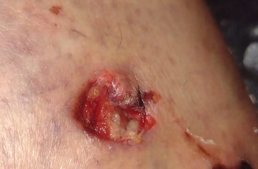 Una motociclista fue atacada por perros en el barrio Jorge Newbery