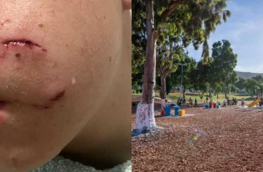 Un perro atacó y mordió a un adolescente en el Parque de la Ciudad