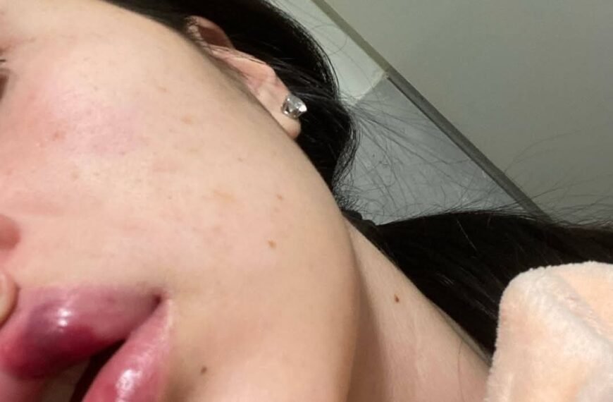 Brutal agresión a una joven por parte de su ex pareja