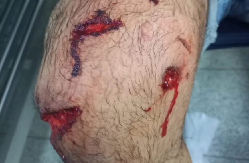 Un hombre sufrió graves heridas tras ser atacado por dos perros dogos