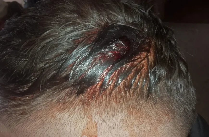 Denuncian que policías irrumpieron en su vivienda y los golpearon brutalmente